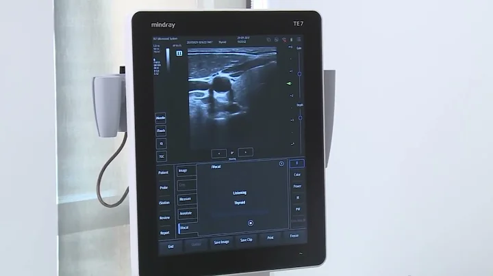 Mindray TE7 ACE Ultrasound System:  Voice Command Recognition