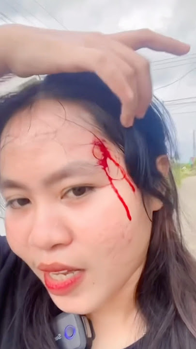 Sakit bangettt🥹😭