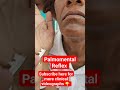 Palmomental reflex - Frontal Release Sign #neurology #medicine