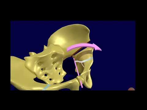 Salter Osteotomy Surgical Technique