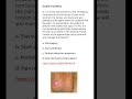Medicine &amp; Surgery MCQs (For MBBS, USMLE, MCCQE &amp; PLAB)
