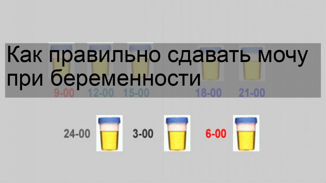 Как сдавать мочу беременным видео. Как сдавать мочу по Нечипоренко при беременности правильно. Анализ мочи по Зимницкому как собирать.