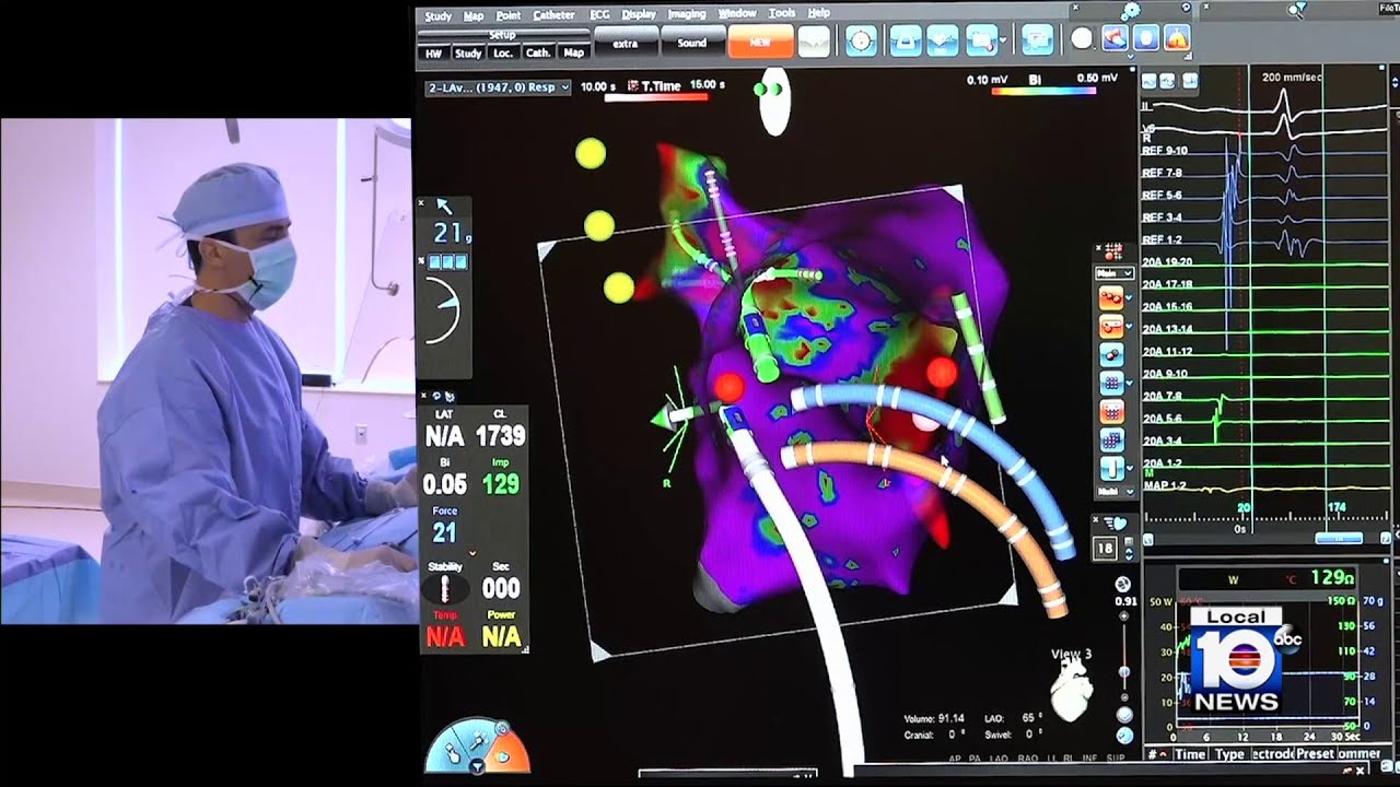 South Florida researchers try new approach to cardiac ablation YouTube