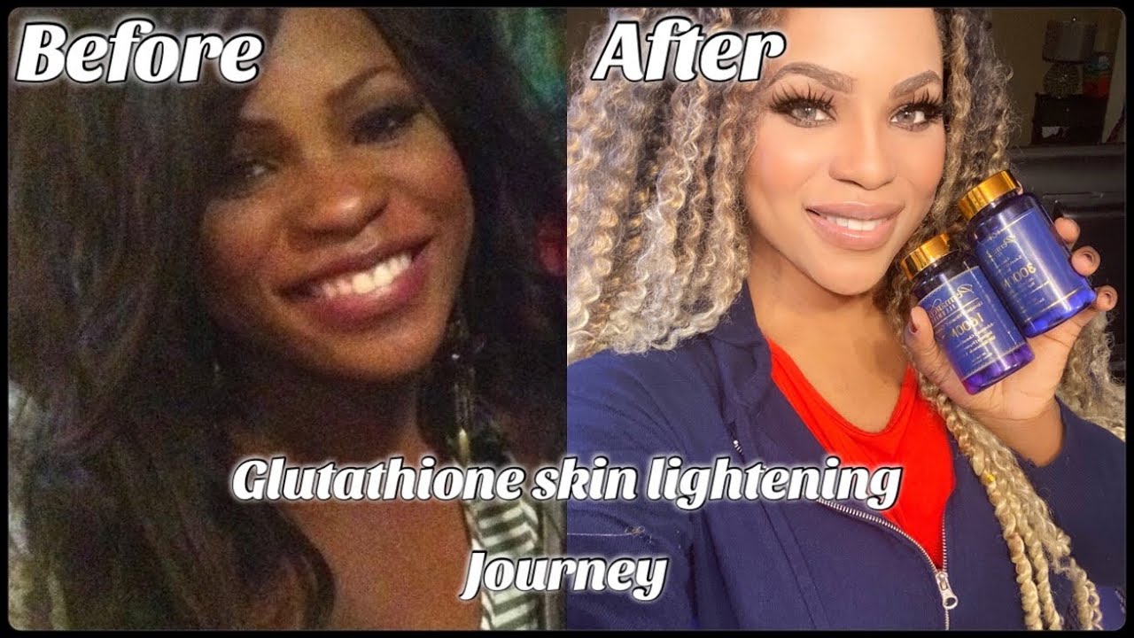 S-Acetyl Glutathione Skin Lightening Darker Skin Tones Permanence Skincare