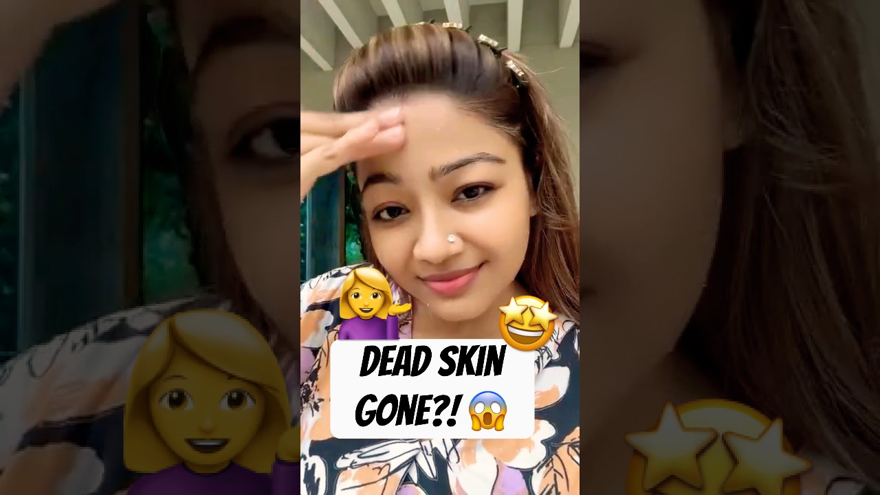 Peeling gel ব্যবহার করার নিয়ম 😱 Dead Skin Removed in Seconds! How to Use Peeling Gel #skincare