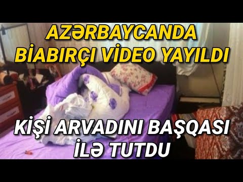 Video: Siding Ya Akriliki: Ambayo Ni Bora - Chuma, Vinyl Au Akriliki, Ni Tofauti Gani, Tofauti Na Saizi Ya Siding