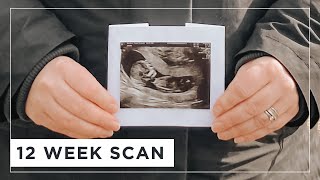 12 Week Scan During Lockdown // Pregnant In Iceland - Pregnant At 40 - Iceland Family Life