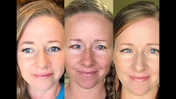 What To Expect With Adult Strabismus Surgery