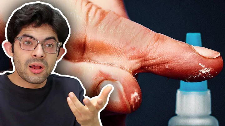 Why Super Glue Is Perfect For Gluing Skin | Hasnaat Reacts