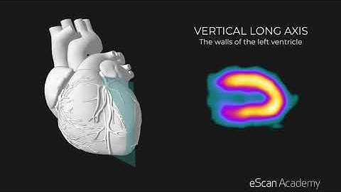 eScan Academy - Display of myocardial perfusion studies