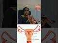 Postmenopausal Bleeding Explained by Dr. Kalpana Ginjupalli | Cervical &amp; Endometrial Polyps  #doctor