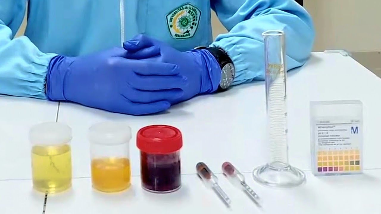 PEMERIKSAAN MAKROSKOPIS URIN