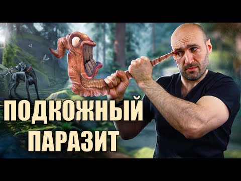 Дирофиляриоз у человека, диагностика, лечение. Реальный опыт врача
