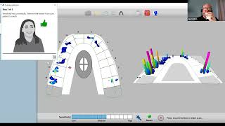 T-Scan Sensitivity Setting : What is it and how to set it