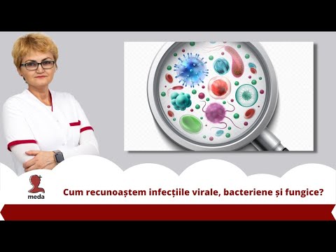 Cum recunoastem si diferentiem infectiile virale, bacteriene si fungice?