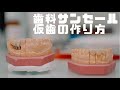 仮歯の作り方　歯科サンセール