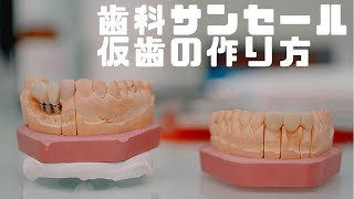 仮歯の作り方　歯科サンセール