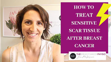 HOW TO TREAT SENSITIVE SCAR TISSUE AFTER BREAST CANCER: Massage to de-sensitise surgical scars