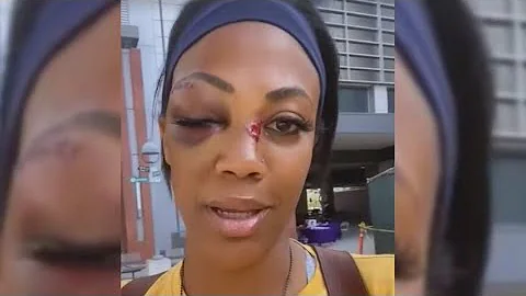 US Olympian Kim Glass allegedly attacked by homele...