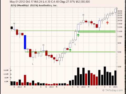 Zeltiq Stock Chart