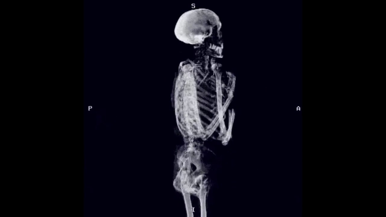 Bones - "MustBeARealDragWakingUpAndBeingYou" (Extended Version)