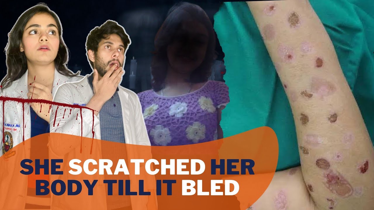 She scratched her body due to board exams pressure |A day in a life of doctor @doctorduo