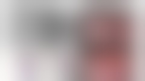 Uniportal VATS Left S1+2 segmentectomy　単孔式胸腔鏡下左肺S1+2区域切除術