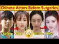 Chinese actors before and after plastic surgeries   incredible changes chinese drama