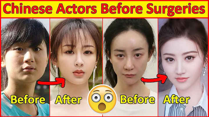Chinese Actors Before and After Plastic Surgeries 😮 , Incredible Changes, Chinese Drama - DayDayNews
