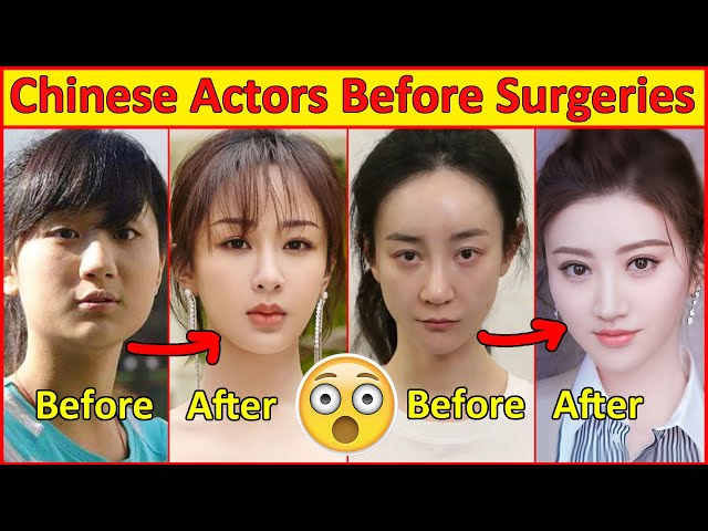 Chinese Actors Before and After Plastic Surgeries 😮 , Incredible Changes, Chinese Drama class=
