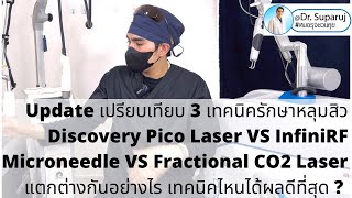 เปรียบเทียบรักษาหลุมสิว Discovery Pico Laser VS InfiniRF VS FxCO2 Laser เทคนิคไหนได้ผลดีที่สุด ?