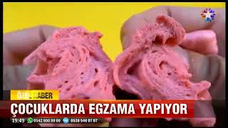 Dr. Selda Yıldırım, Slime Cilde Zararları