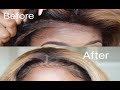 How to Repair a BALD FRONTAL/ MAKING BABY HAIRS