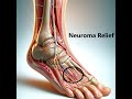 How To Solve A Morton S Neuroma 