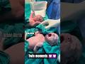 These cute preterm twins were born to a 40 yrsold mother, who was previously on oral contraception.