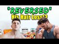 How Brandon Harding "Reversed" His Hair Loss - My Analysis