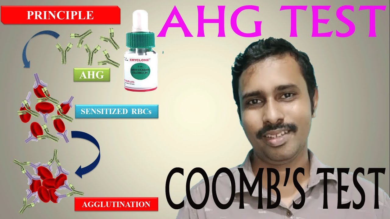 coomb-s-test-dct-direct-coombs-test-ict-indirect-coombs-test-antiglobulin-test-dat-iat-ahg-test