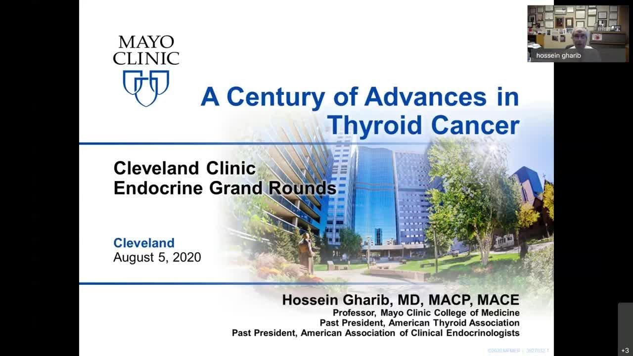 Advances in Thyroid Cancer 1920-2020