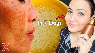 Rice Water Challenge : Lighten Your Scars, Dark Spots, Discoloration & Get Glowing Spotless Skin💕