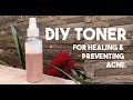 HomeMade Skincare - DIY Toner For All Skin Problems | 100% Effective | GLOSSIPS