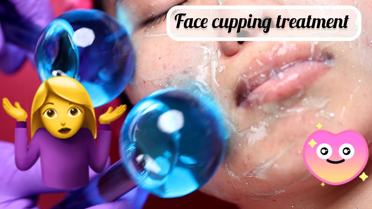 Face cupping 