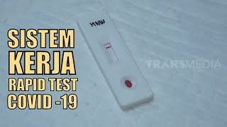 How to perform the Acro 2019 nCoV IgG/IgM Rapid Test