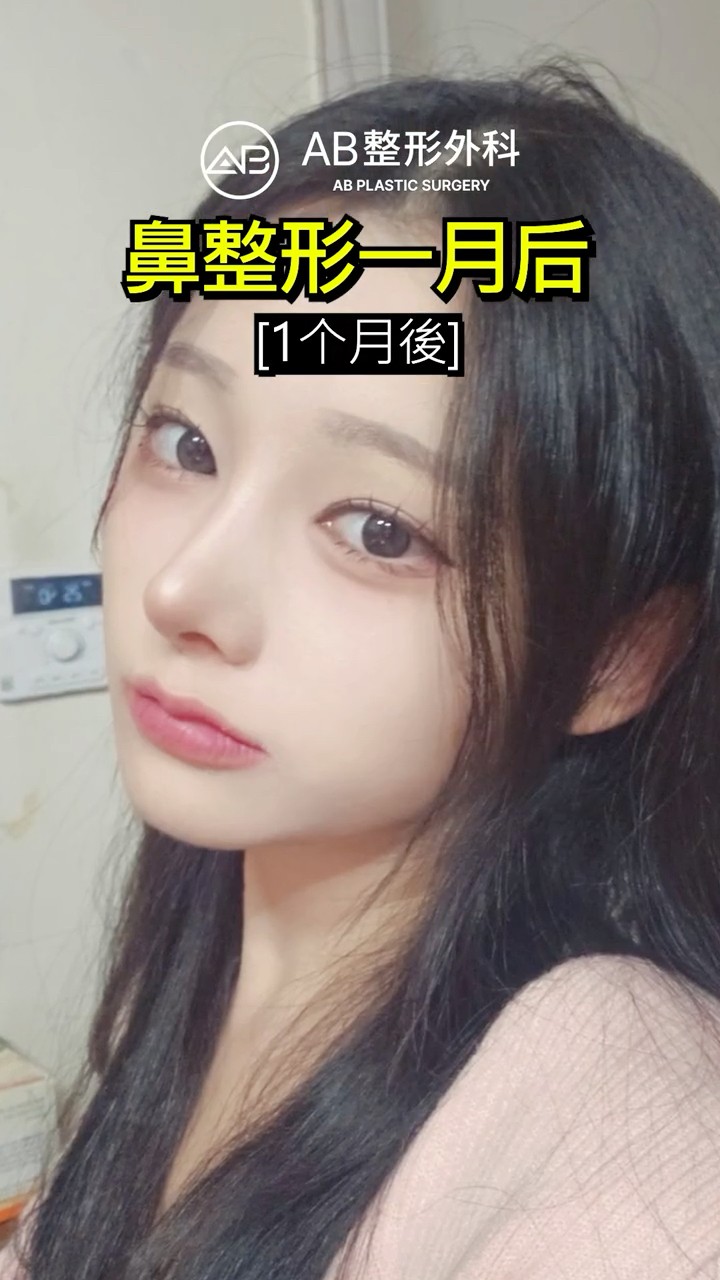 第一次隆鼻…沒想到效果這麼誇張！ #shorts
