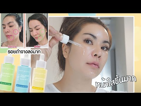 รีวิว เซรั่มตัวดังของ Cute Press ตัวช่วยลดจุดด่างดำ ผิวหน้ากระจ่างใสแบบดารา l แรบบิทมาแชร์