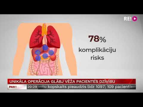 Video: Vai onkologi veic operācijas?