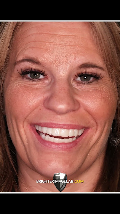 Download lagu You Won't Believe These Smile Transformations!