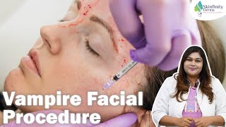 Vampire Facial Step By Step Procedure | PRP Treatment for Face | Vampire Facial in Delhi