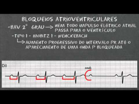 Vídeo: Bloqueio Cardíaco (primeiro Grau) Em Cães