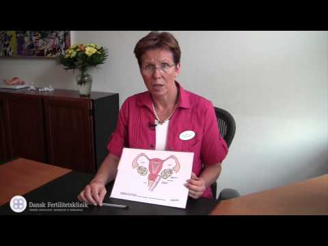 Video: Befrugtning In Vitro (IVF): Fremgangsmåde, Forberedelse Og Risici