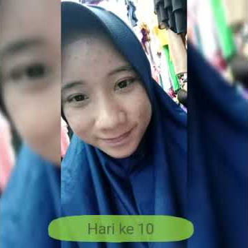 Rivew pemakaian cream HN
